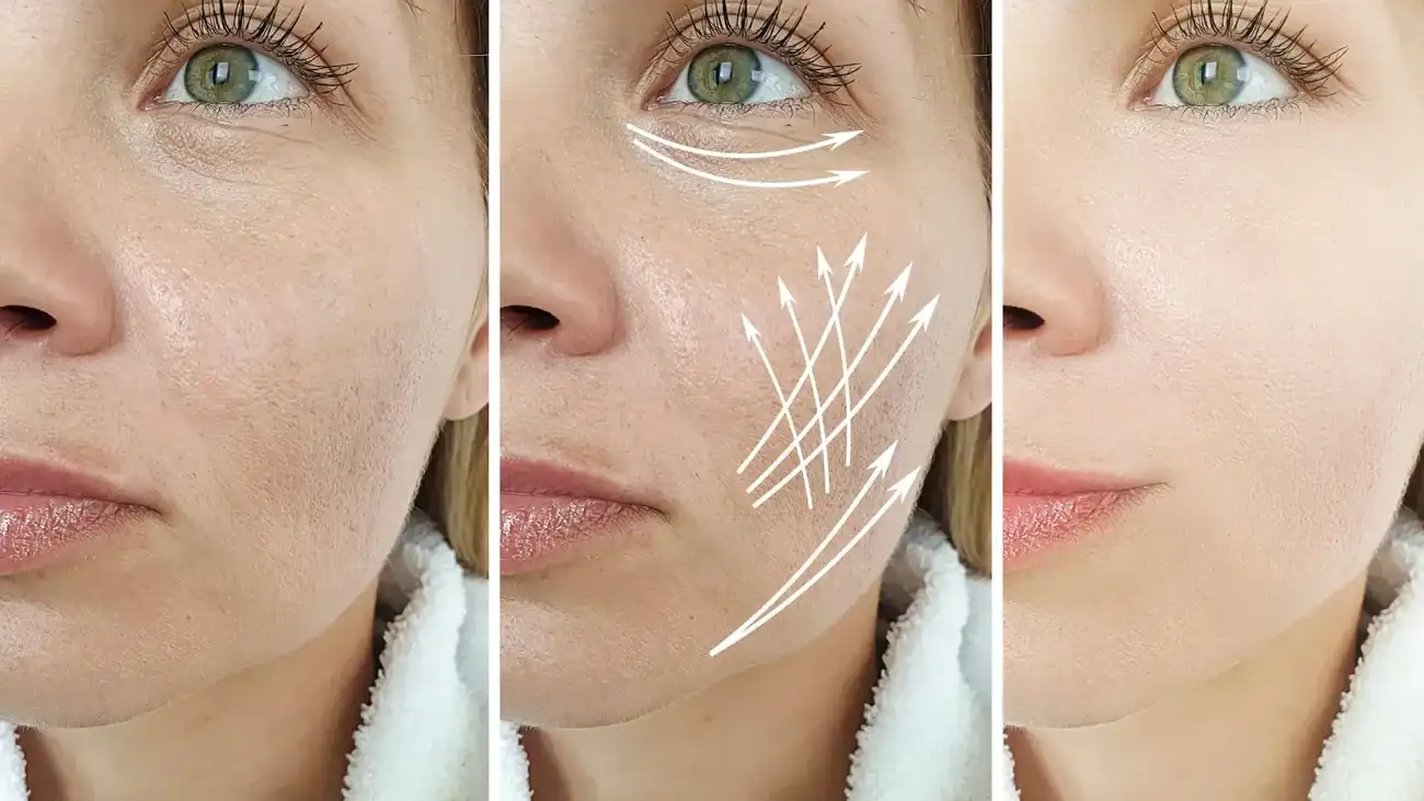 Can One Treatment Really Tackle More Than One Skin Concern Eton?