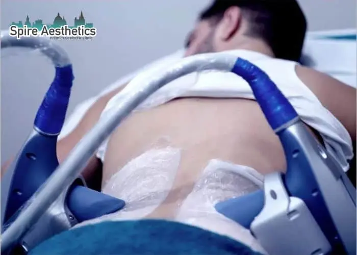 Man having fat freezing treatment done on love handles before a competitions Eton to create a sculpted look.