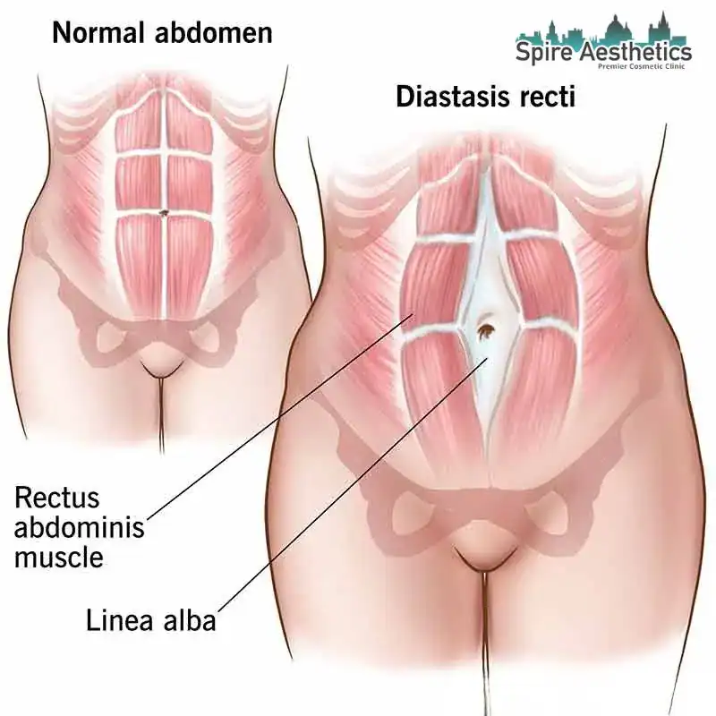When Will My Belly Feel Normal Again Eton?